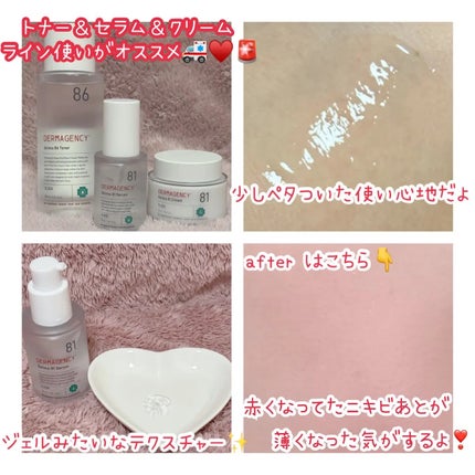 ダーマジェンシー ゼロカ81 セラム/DERMAGENCY/美容液を使ったクチコミ(2枚目)