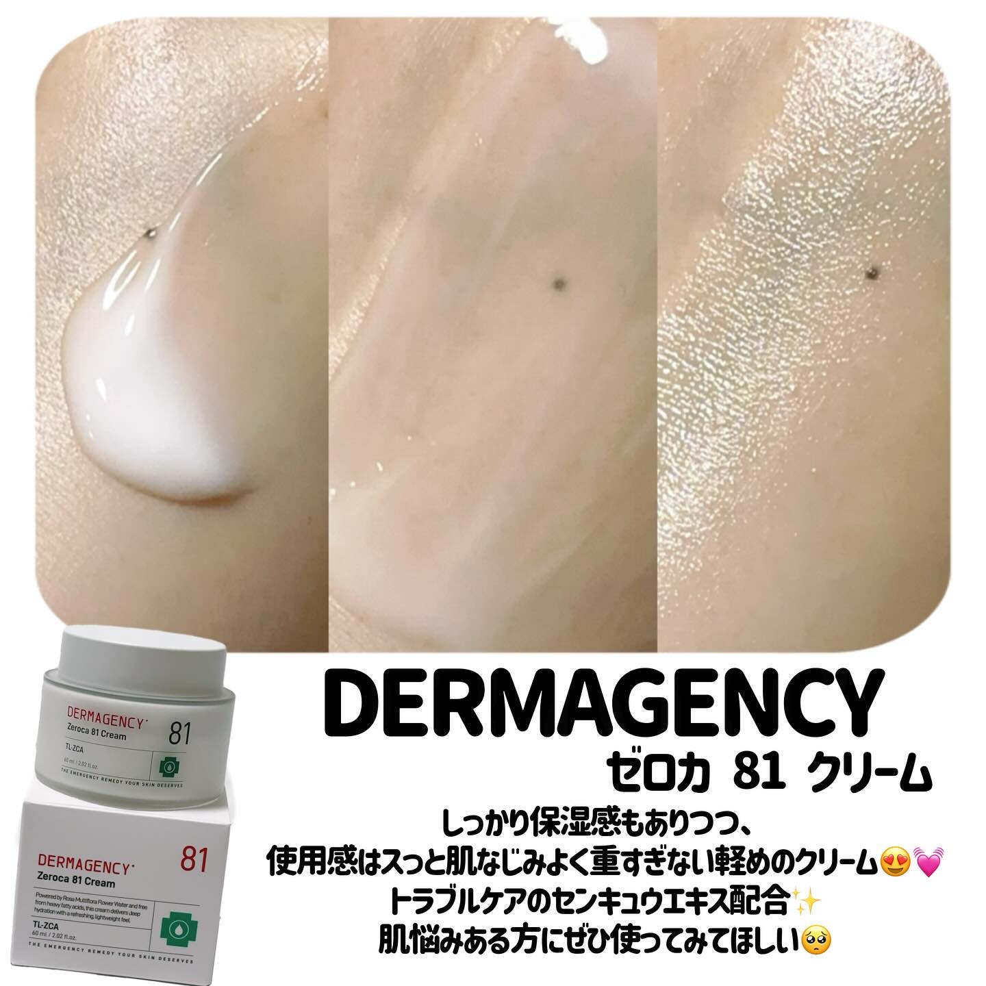 ダーマジェンシー ゼロカ81 クリーム/DERMAGENCY/フェイスクリームを使ったクチコミ（2枚目）