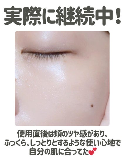 アドバンスト ビューティ コンセントレート/ファンケル/美容液を使ったクチコミ(5枚目)