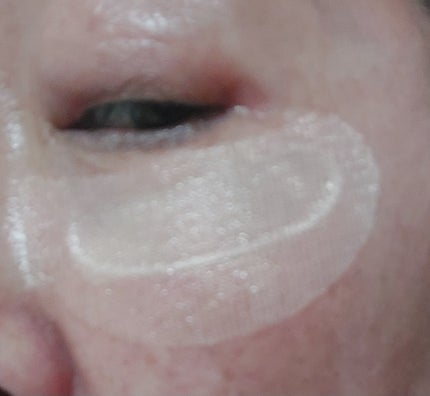 IC.U HA マイクロパッチ AX フィラー/ドクターフィルコスメティクス/アイケア・アイクリームを使ったクチコミ(4枚目)