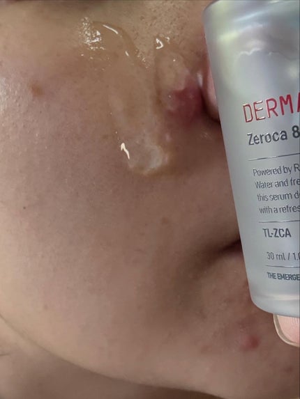 ダーマジェンシー ゼロカ81 セラム/DERMAGENCY/美容液を使ったクチコミ(4枚目)