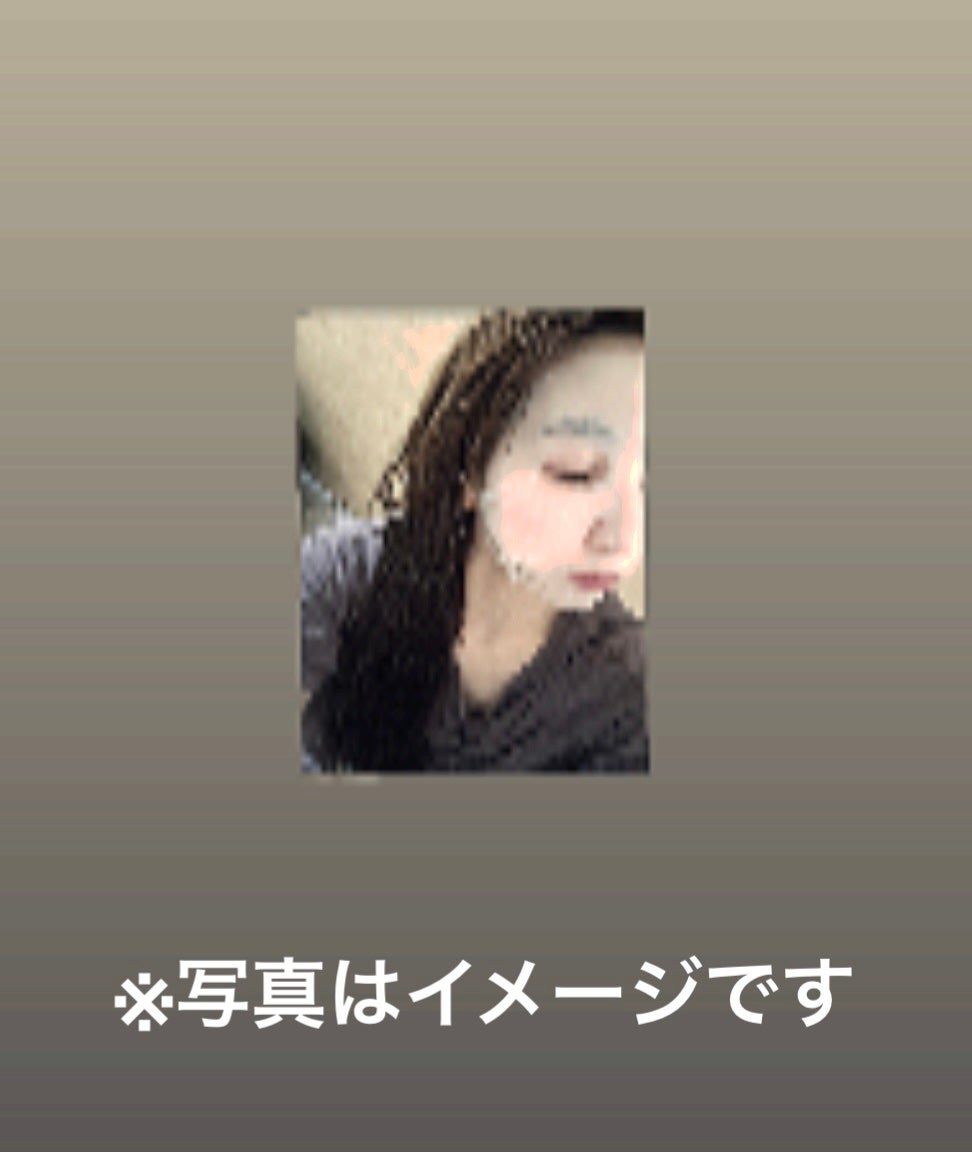 アゼライン酸15 インテンスカーミングセラムインマスク/Anua/シートマスク・パックを使ったクチコミ(2枚目)