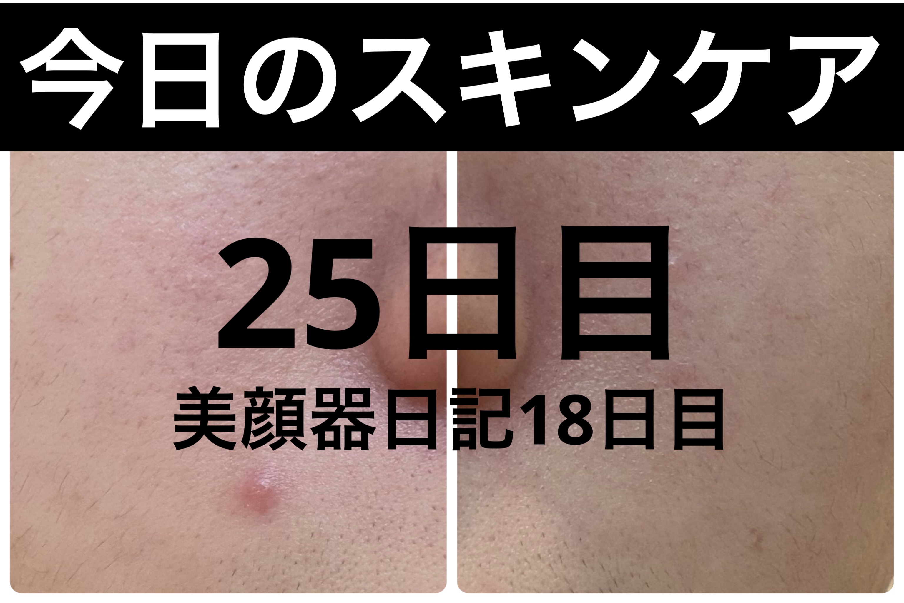 薬用雪肌精 ブライトニング クレンジング オイル[医薬部外品]/雪肌精/オイルクレンジングを使ったクチコミ（1枚目）