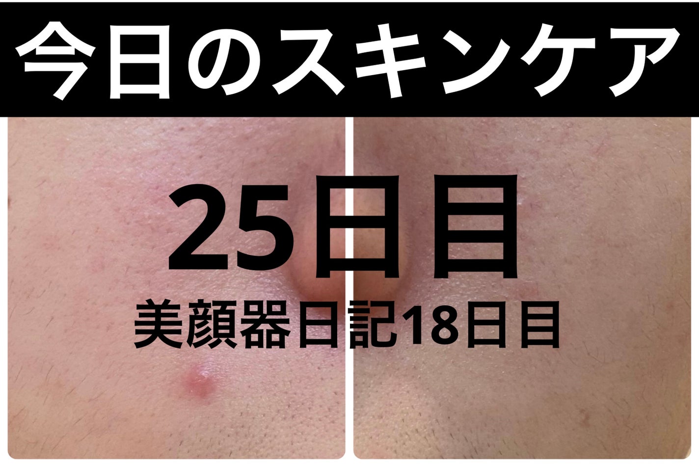 AGE-R ブースタープロ/MEDICUBE/美顔器・マッサージを使ったクチコミ(1枚目)