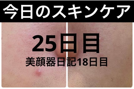 エターナルアイクリーム 8g/リュバンブラン/アイケア・アイクリームを使ったクチコミ(1枚目)