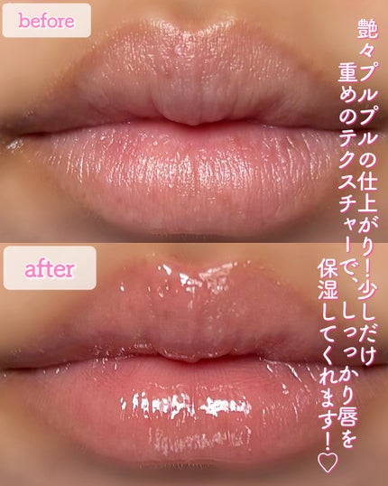 ちゅるリップランパー/muice/リッププランパーを使ったクチコミ(6枚目)