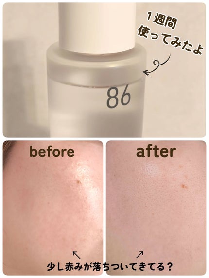 ダーマジェンシー ゼロカ86 トナー/DERMAGENCY/化粧水を使ったクチコミ(4枚目)