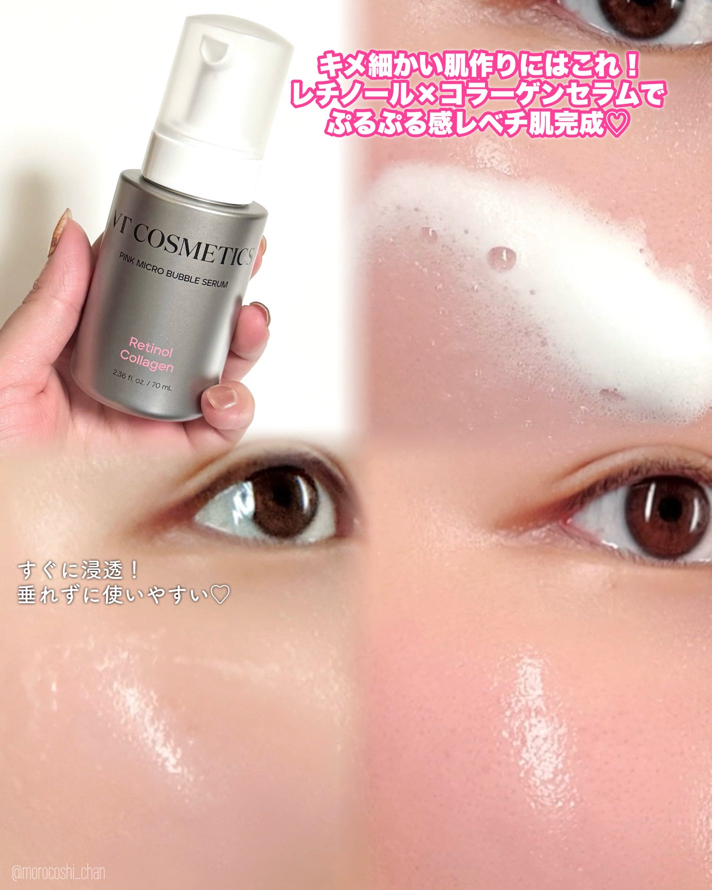 PDRN ヒアルロン酸 ミントマイクロバブルセラム/VT/美容液を使ったクチコミ(2枚目)