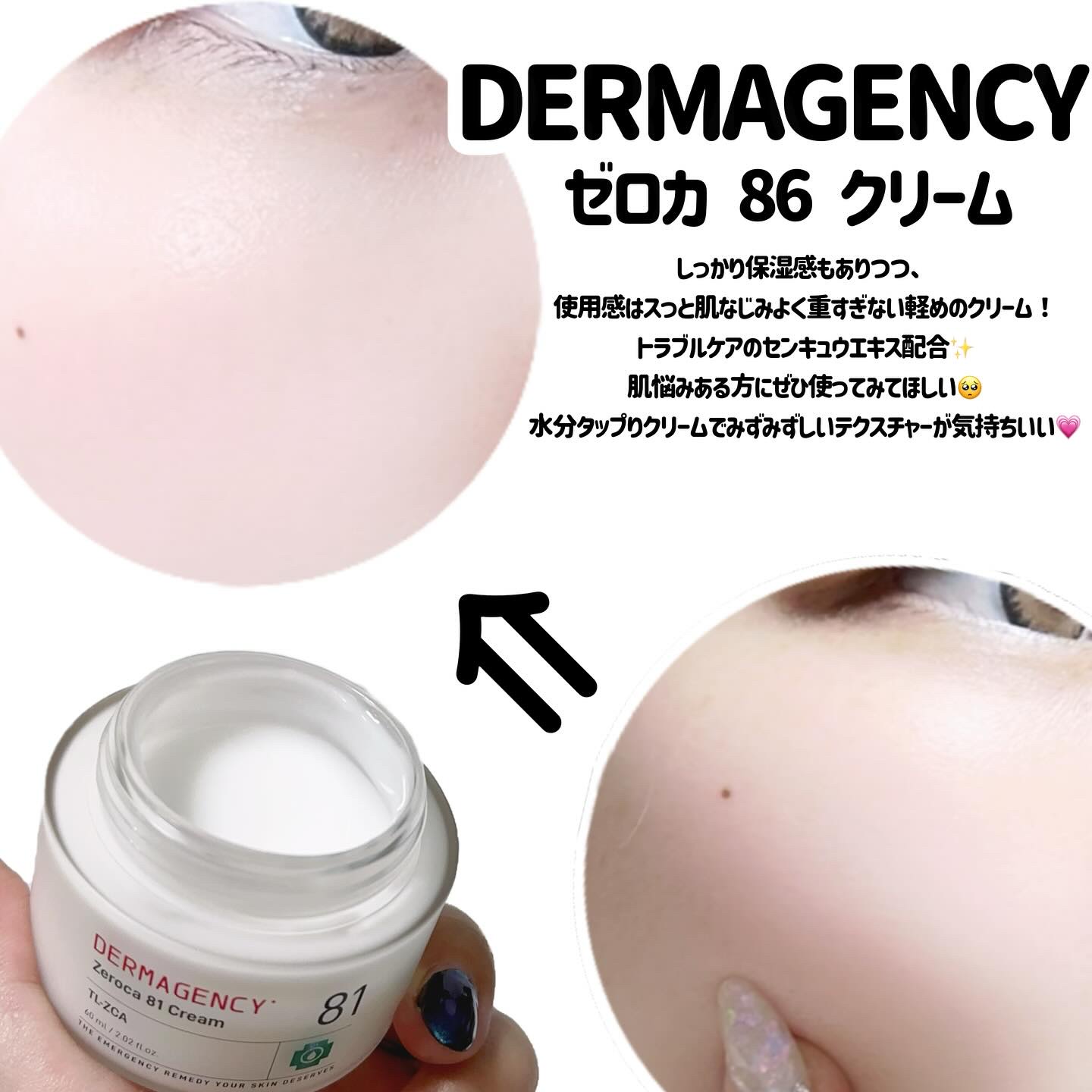 ダーマジェンシー ゼロカ81 クリーム/DERMAGENCY/フェイスクリームを使ったクチコミ（2枚目）