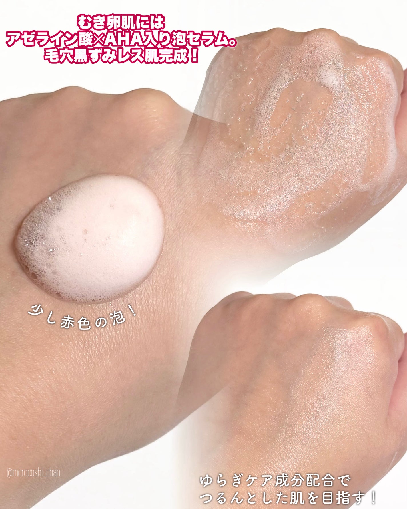 PDRN ヒアルロン酸 ミントマイクロバブルセラム/VT/美容液を使ったクチコミ(3枚目)