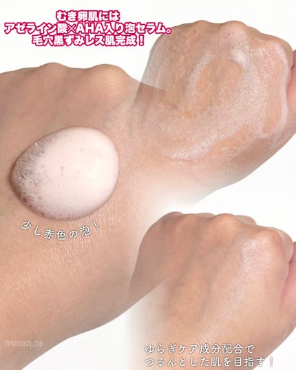 PDRN ヒアルロン酸 ミントマイクロバブルセラム/VT/美容液を使ったクチコミ(3枚目)