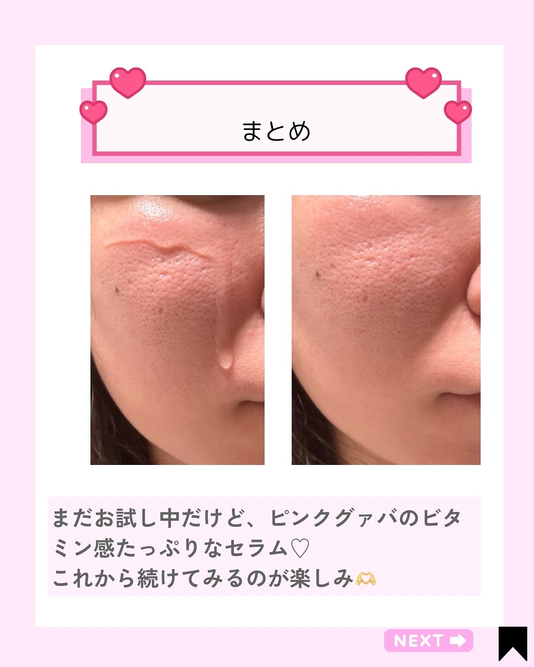 Kana on LIPS 「BeginSの「ピンクグァバグルタチオン痕跡セラム」🫧水みたい..」(5枚目)