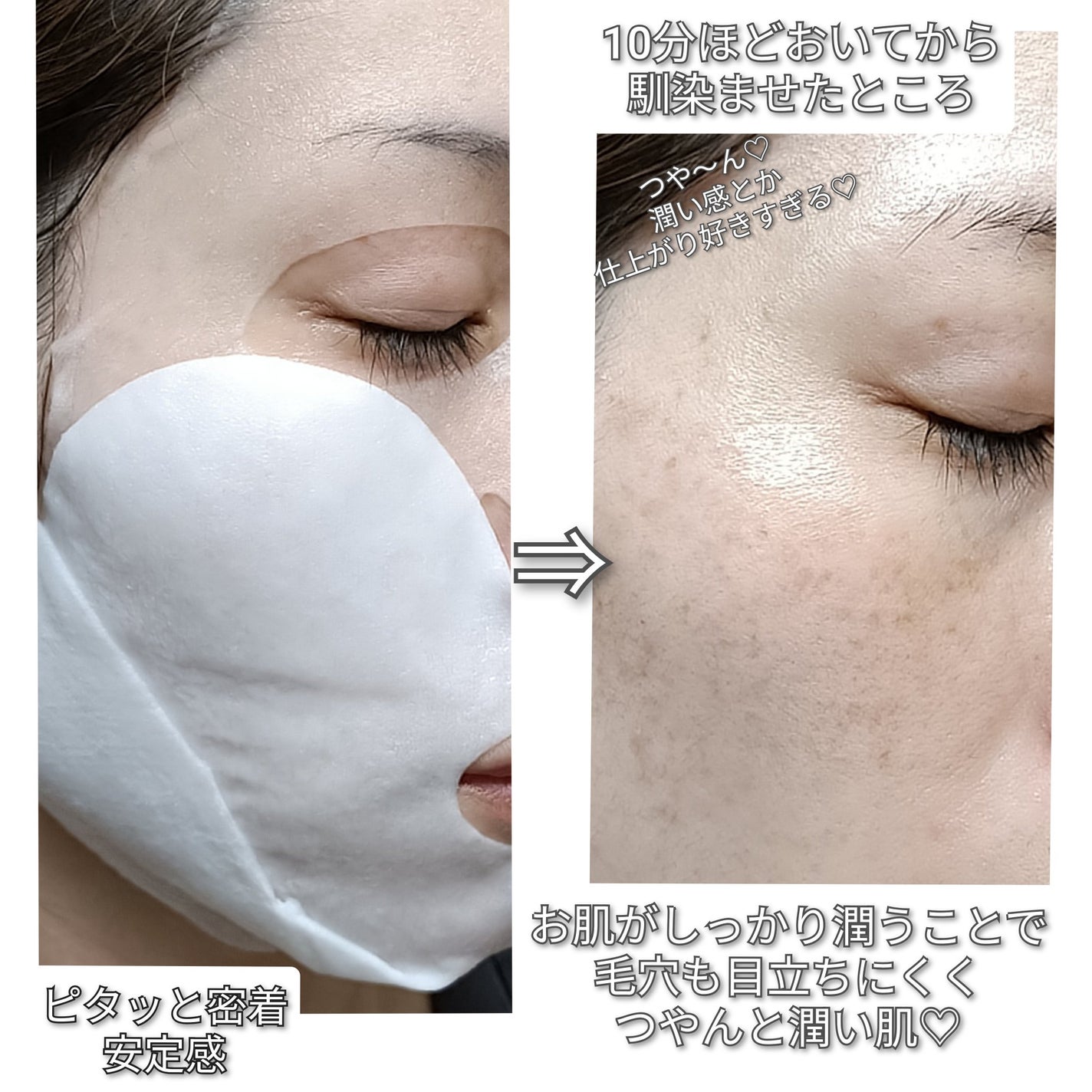 デュイセル プライベートケアマスク/DEWYCEL/シートマスク・パックを使ったクチコミ(3枚目)