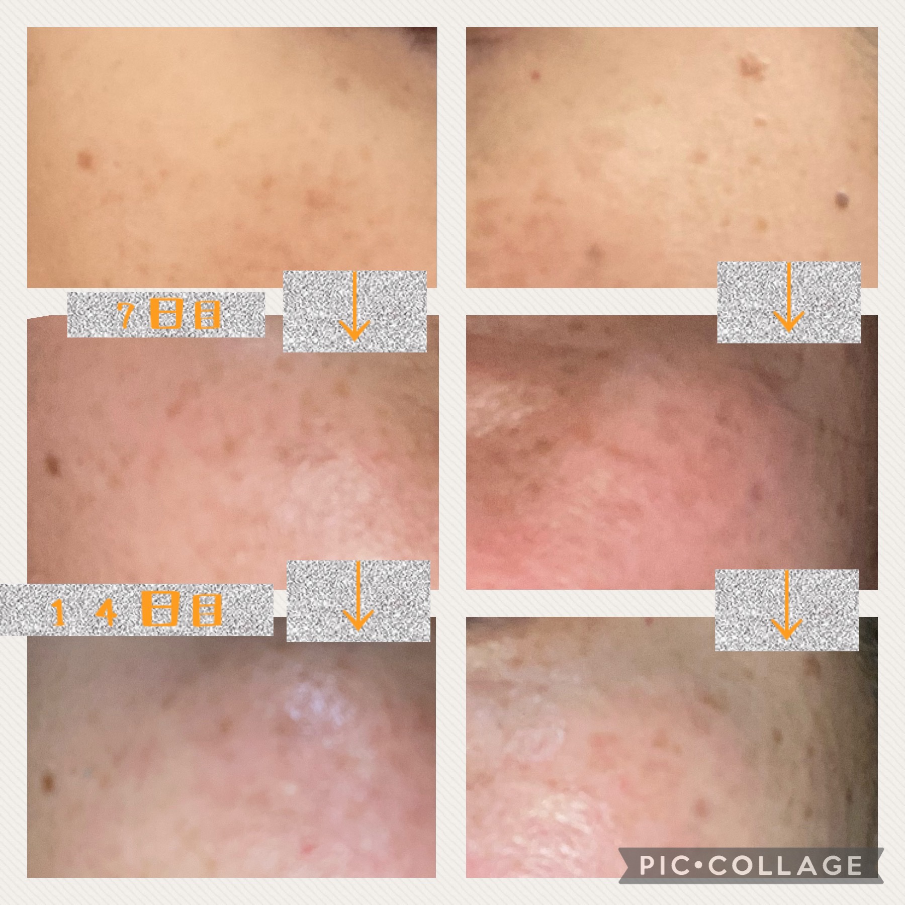 リポソーム ビタミンC & レチノール 配合 プルオイVC1500/マザーリーフ/美容サプリメントを使ったクチコミ（1枚目）