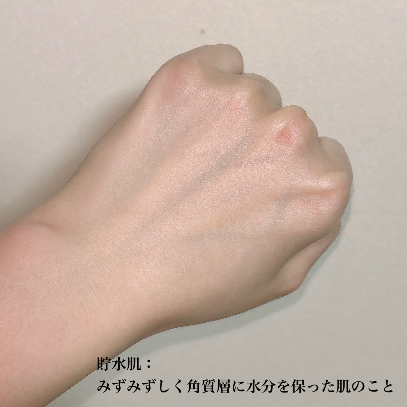 ミノン アミノモイスト モイストチャージ ミルク/ミノン/乳液を使ったクチコミ(5枚目)