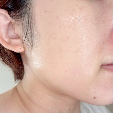 ポアタイトニングトナーパッド/REJURAN COSMETICS/トナーパッドを使ったクチコミ(3枚目)