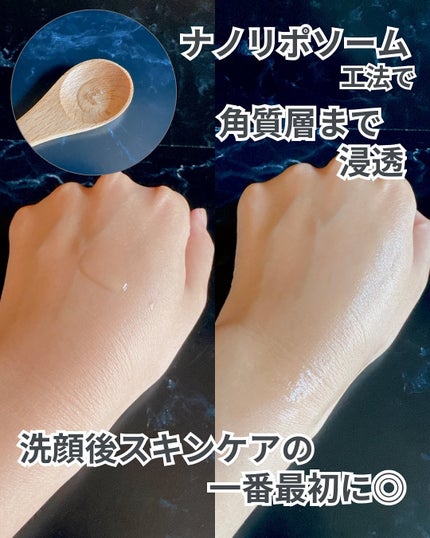 スキンブースティングフォルテセラム/essenciel/美容液を使ったクチコミ(3枚目)