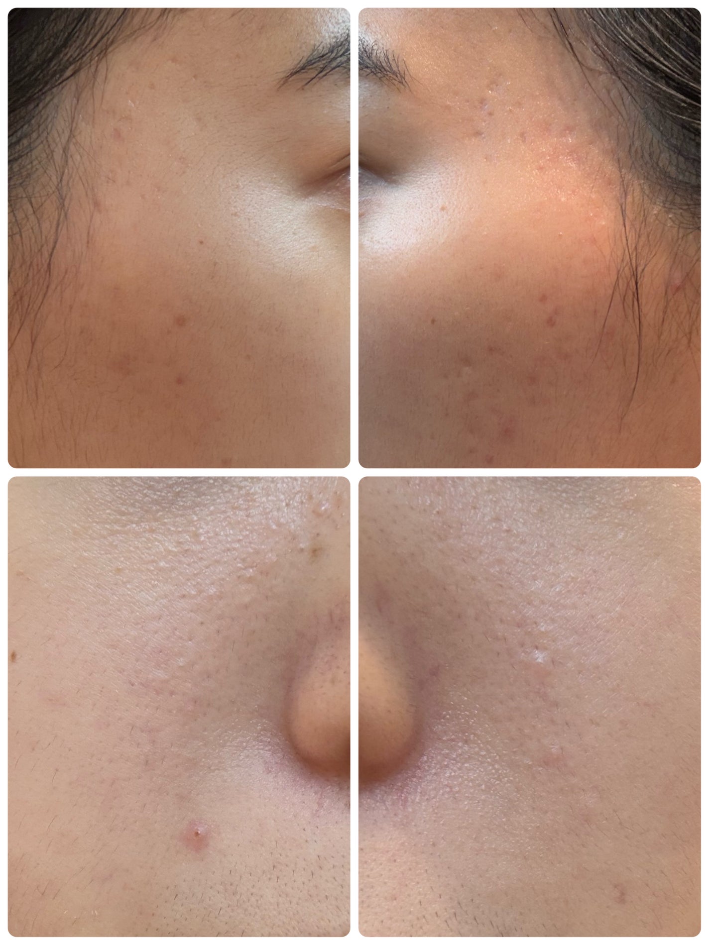 AGE-R ブースタープロ/MEDICUBE/美顔器・マッサージを使ったクチコミ(2枚目)