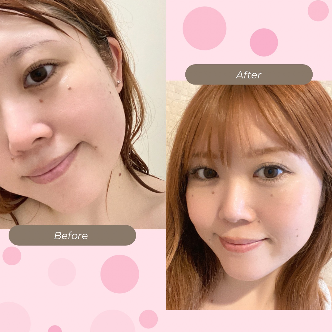 C×AZ ダーマインショット200/ESIENCE/美容液を使ったクチコミ（3枚目）