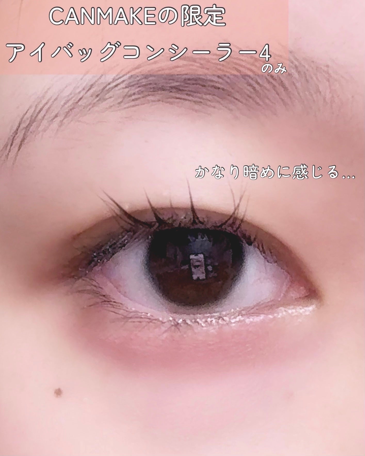 ã¢ã€ããã°ã³ã³ã·ãŒã©ãŒ/ãã£ã³ã¡ã€ã¯/ãã³ã·ã«ã³ã³ã·ãŒã©ãŒã䜿ã£ãã¯ãã³ãïŒ3æç®ïŒ