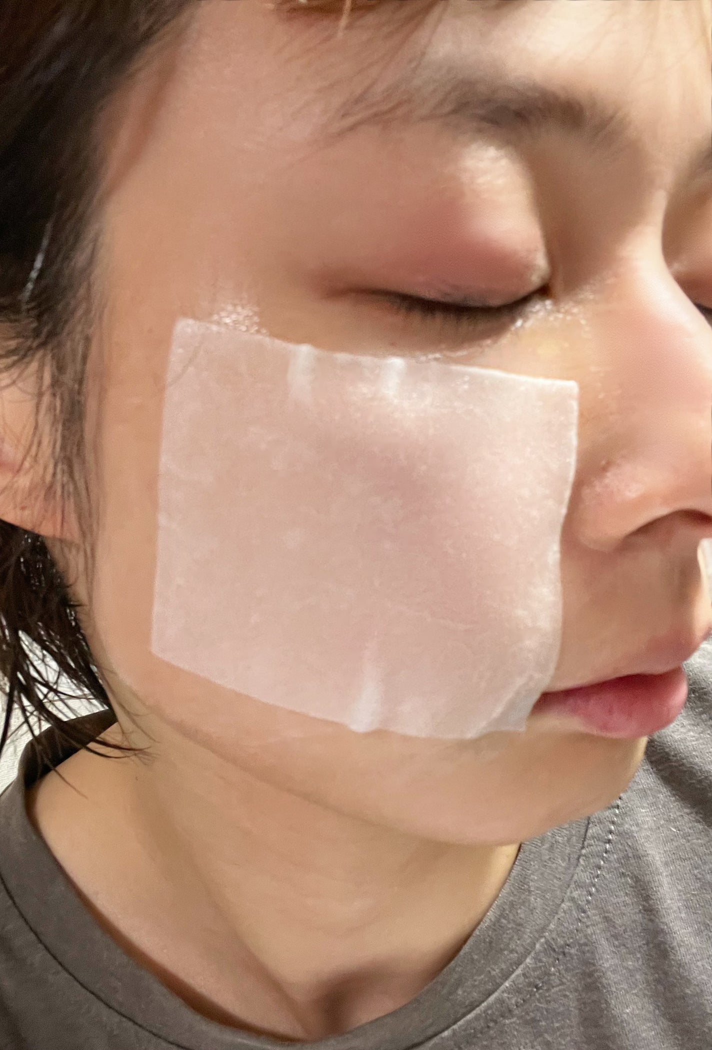 リズム ピコレーザー ニードルスポットパック/RISM/シートマスク・パックを使ったクチコミ(3枚目)