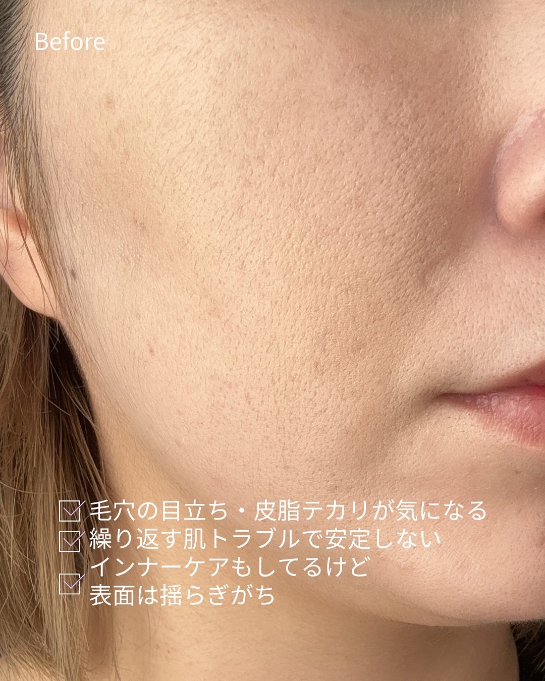 ダーマジェンシー ゼロカ81 セラム/DERMAGENCY/美容液を使ったクチコミ(2枚目)