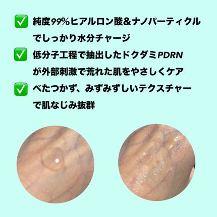 ウォータリー ヒアル セラム/Real Barrier/美容液を使ったクチコミ(2枚目)