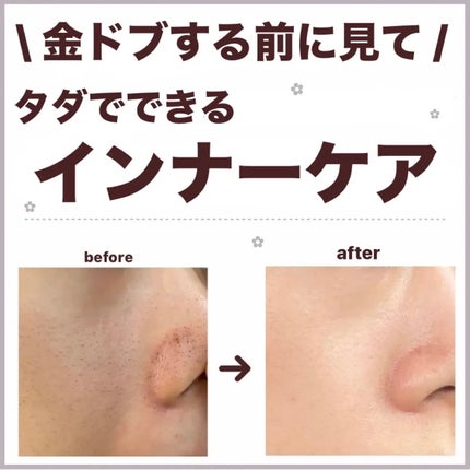 を使ったクチコミ(1枚目)