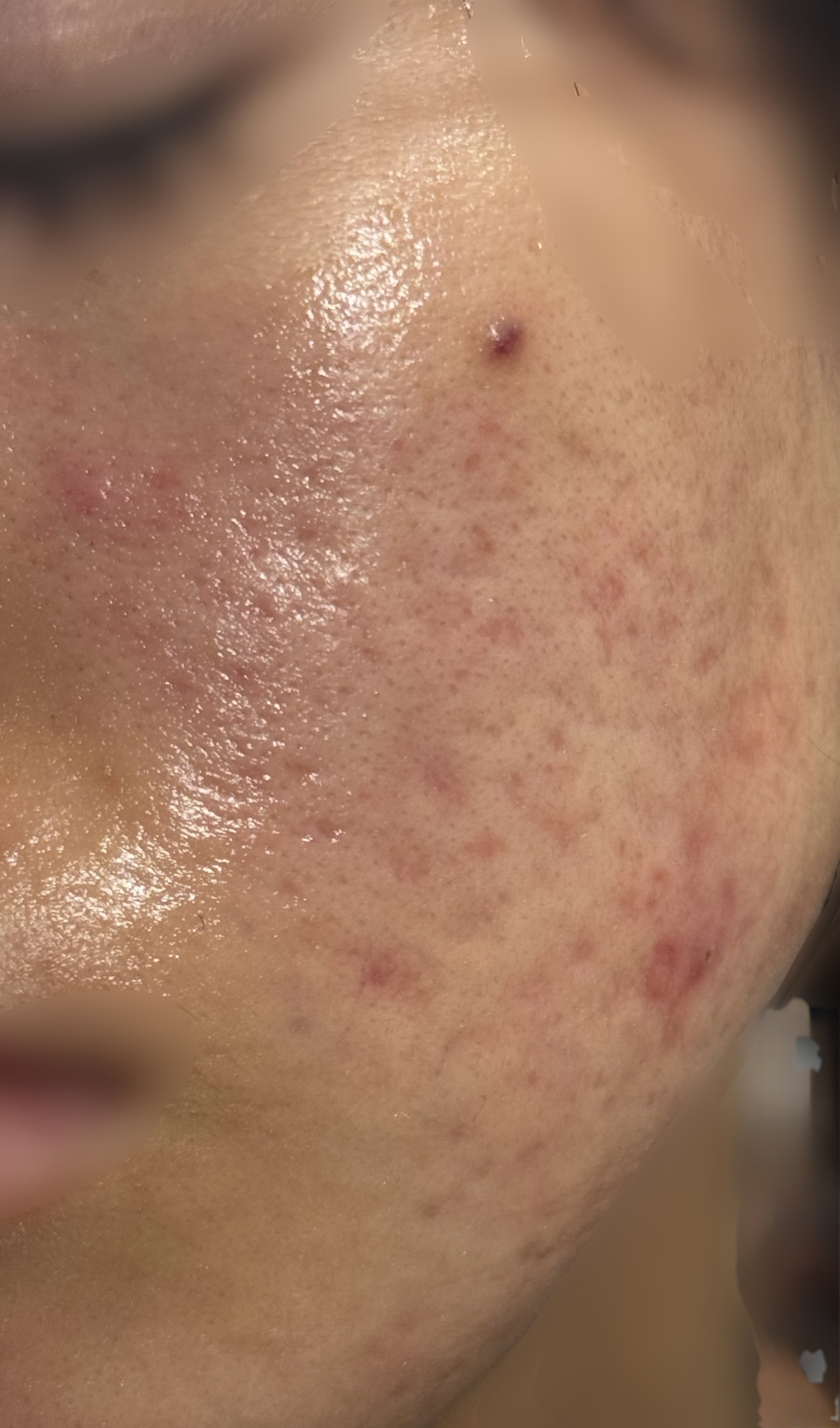 リペアホワイトピール/コラージュ/洗顔パウダーを使ったクチコミ（2枚目）