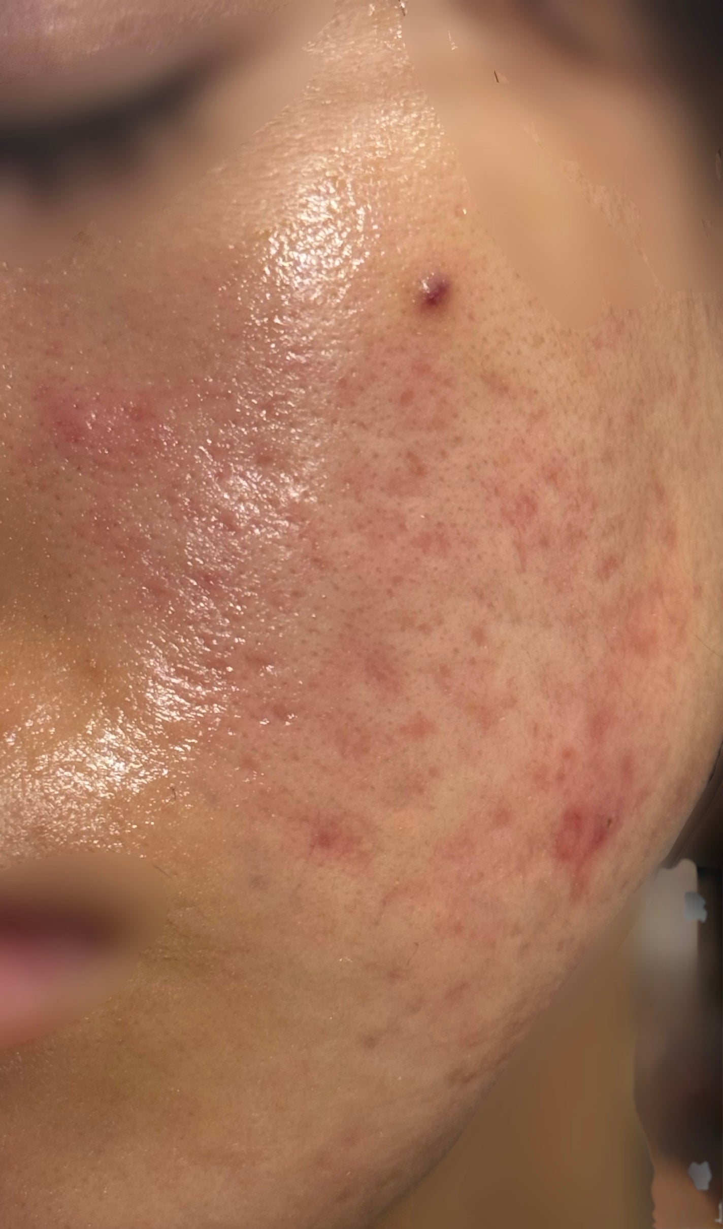 リペアホワイトピール/コラージュ/洗顔パウダーを使ったクチコミ(2枚目)