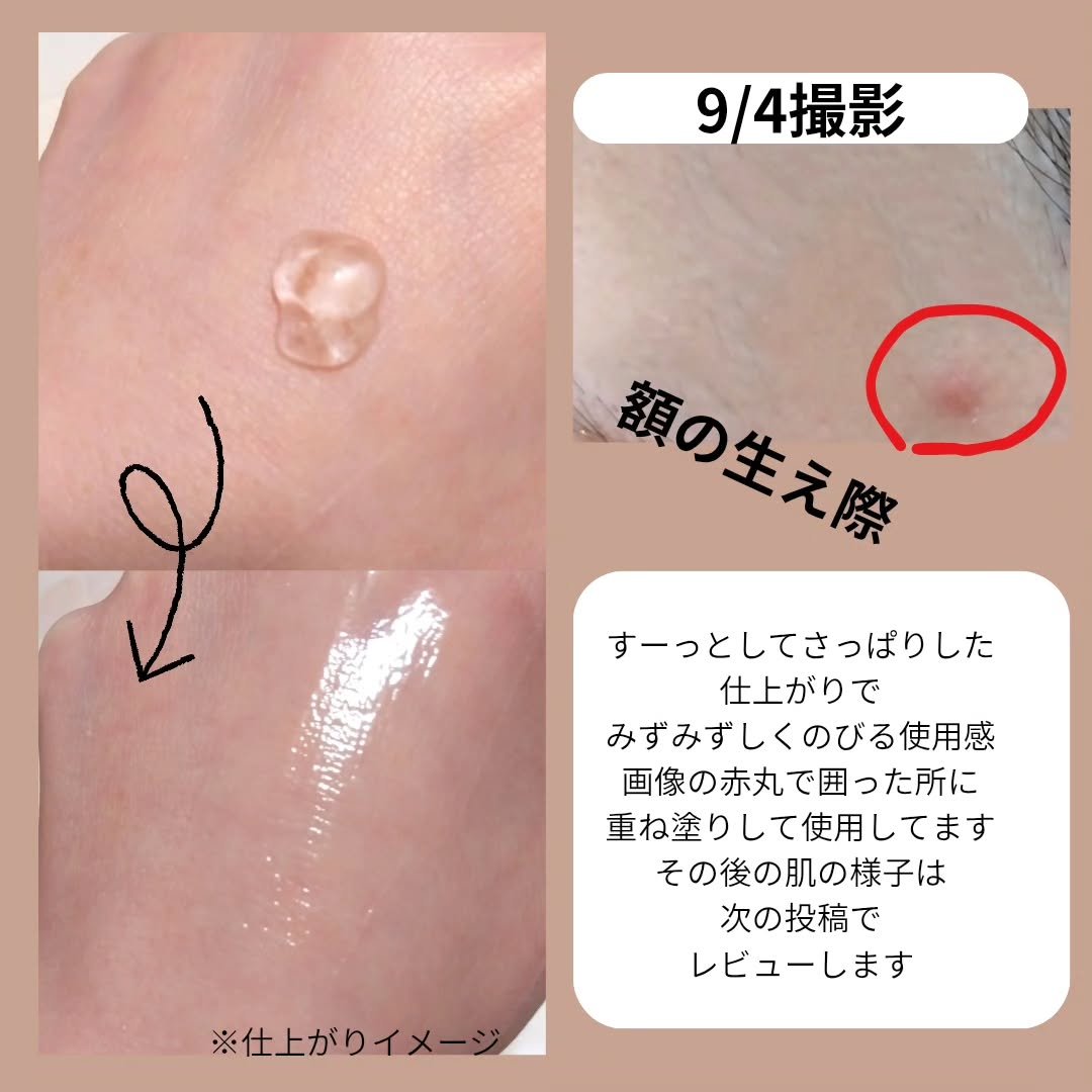 ダーマジェンシー ゼロカ81 セラム/DERMAGENCY/美容液を使ったクチコミ（3枚目）