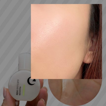 エポホワイティア 15ml/epo/美容液の画像