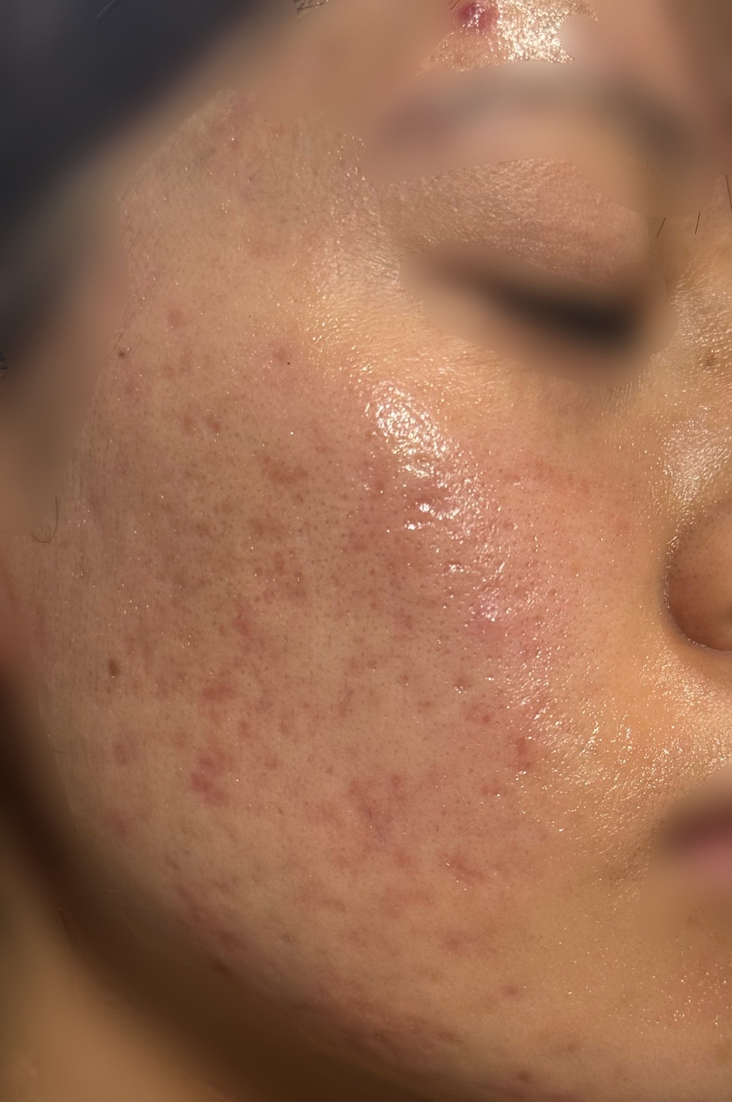 リペアホワイトピール/コラージュ/洗顔パウダーを使ったクチコミ(1枚目)