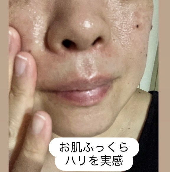 hirokoðžã¹ãã³ã±ã¢&ã³ã¹ã¡å€§å¥œã on LIPS ãã°ã¬ã€ã¹ã¯ã³Â ãªã³ã¯ã«ã±ã¢Â ãªã³ã¯ã«ãªããVããã€ããªãã¢ã¯ãª..ãïŒ6æç®ïŒ