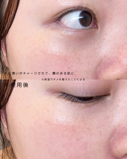 PHセンシティブマスクスージング&モイスト/SAM'U/シートマスク・パックを使ったクチコミ(5枚目)