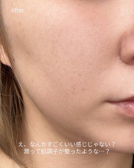 ダーマジェンシー ゼロカ81 セラム/DERMAGENCY/美容液を使ったクチコミ(3枚目)