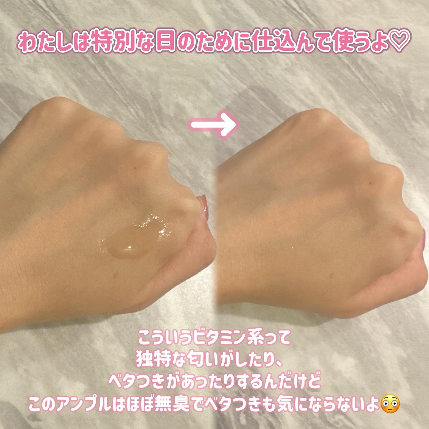 ビタミンアンプル2ml（5本入り）/Spela/美容液を使ったクチコミ（3枚目）