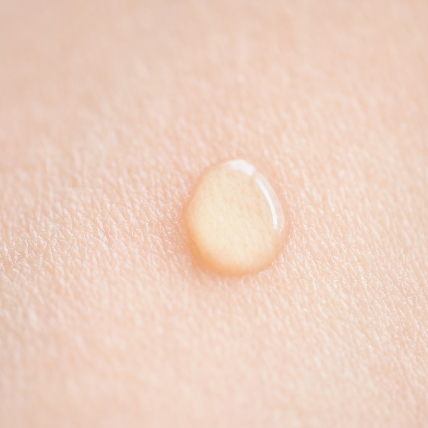 REJURAN ポアタイトニングアンプル 30ml/REJURAN COSMETICS/美容液を使ったクチコミ(4枚目)