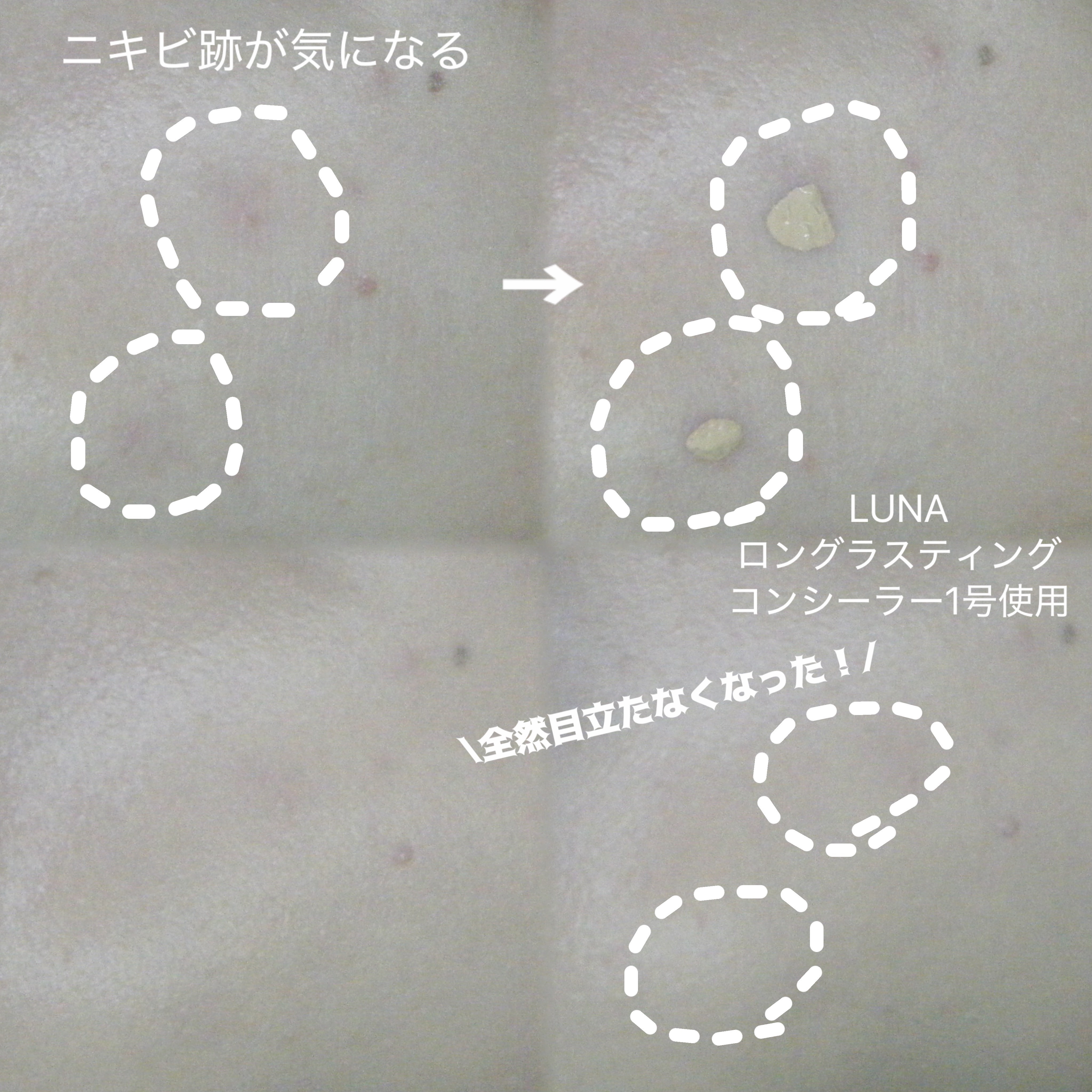 ロングラスティングチップコンシーラー/LUNA/リキッドコンシーラーを使ったクチコミ（2枚目）