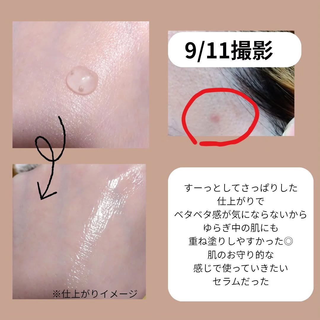 ダーマジェンシー ゼロカ81 セラム/DERMAGENCY/美容液を使ったクチコミ（3枚目）