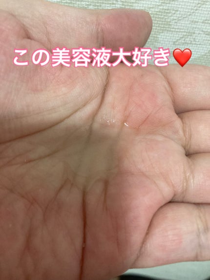 5番 白玉グルタチオンC美容液/numbuzin/美容液を使ったクチコミ(3枚目)