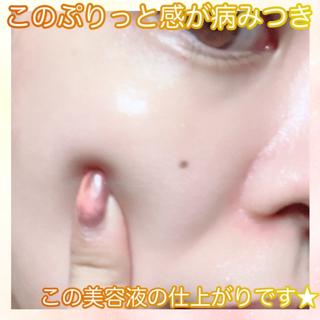 アットクリニック プランピングショット/DOMINAS/美容液を使ったクチコミ(2枚目)