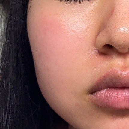 シカレチA エッセンス0.1/VT/美容液を使ったクチコミ(8枚目)