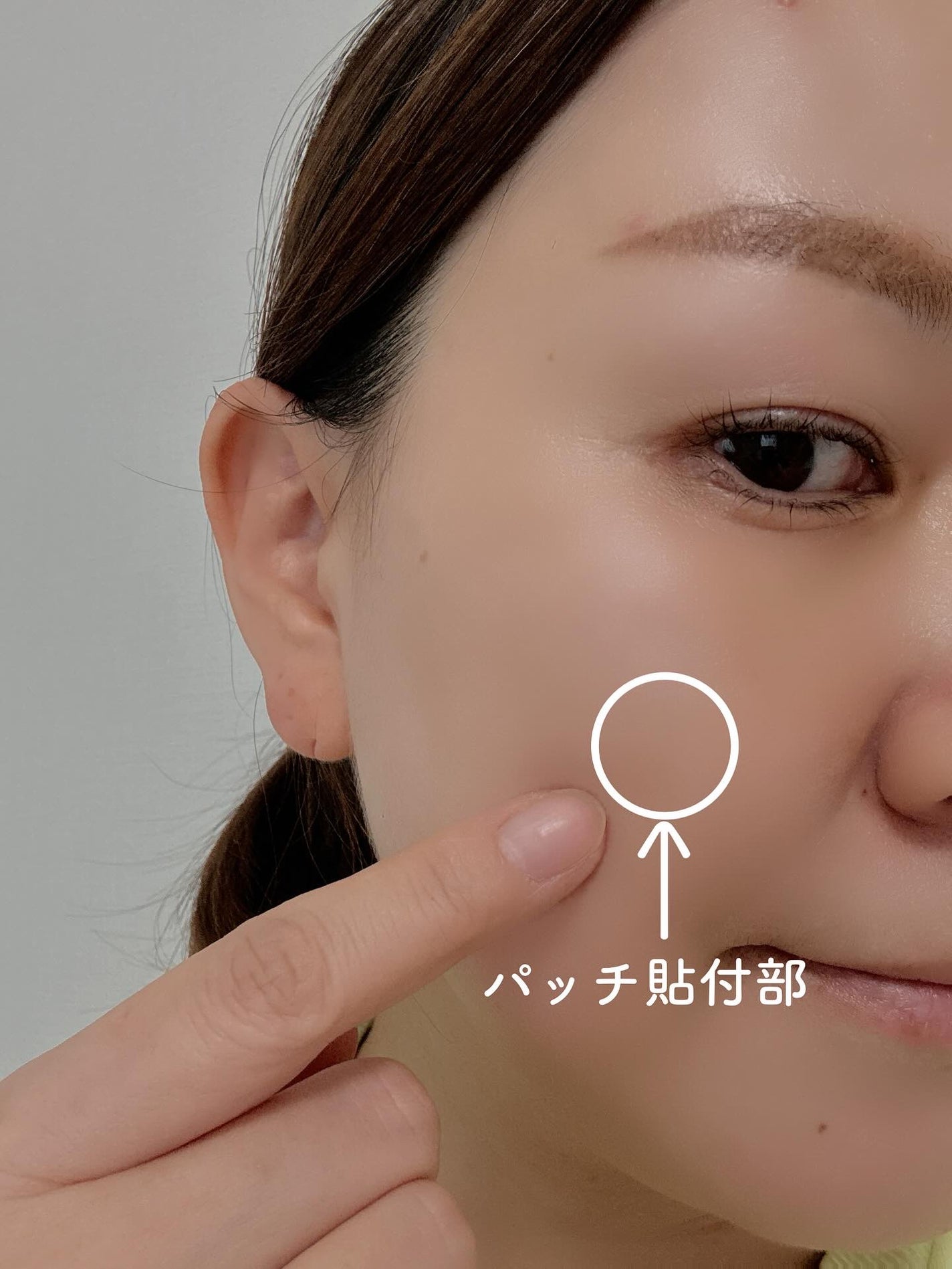 プロアクティブ スキンケアパッチ/プロアクティブ/にきびパッチを使ったクチコミ(6枚目)