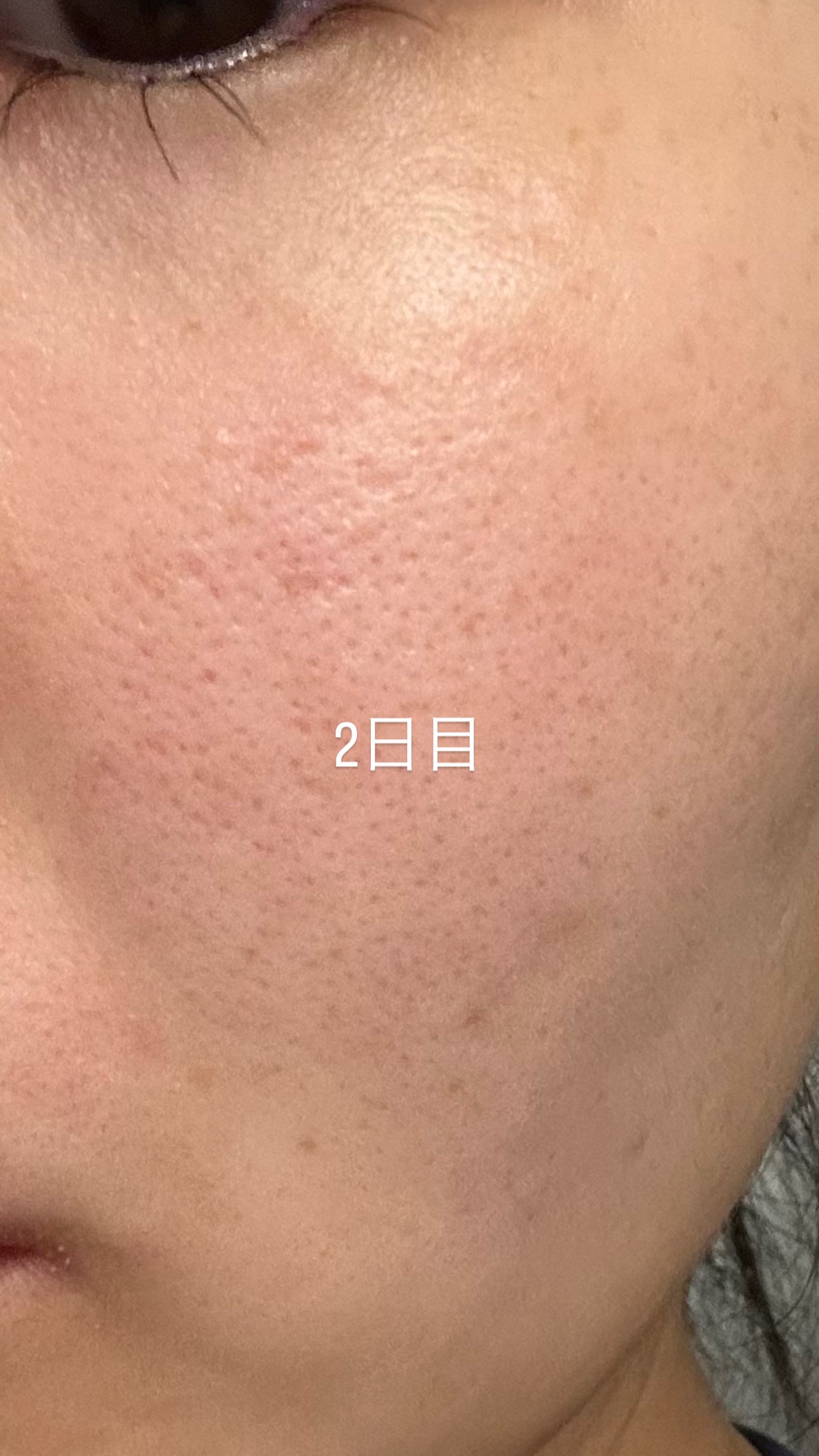 PDRNキューブセラム/DPPR/美容液を使ったクチコミ（3枚目）