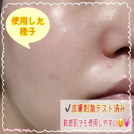 スピテラパーミアPDRNアンプル/NUDIQUE/美容液を使ったクチコミ(5枚目)