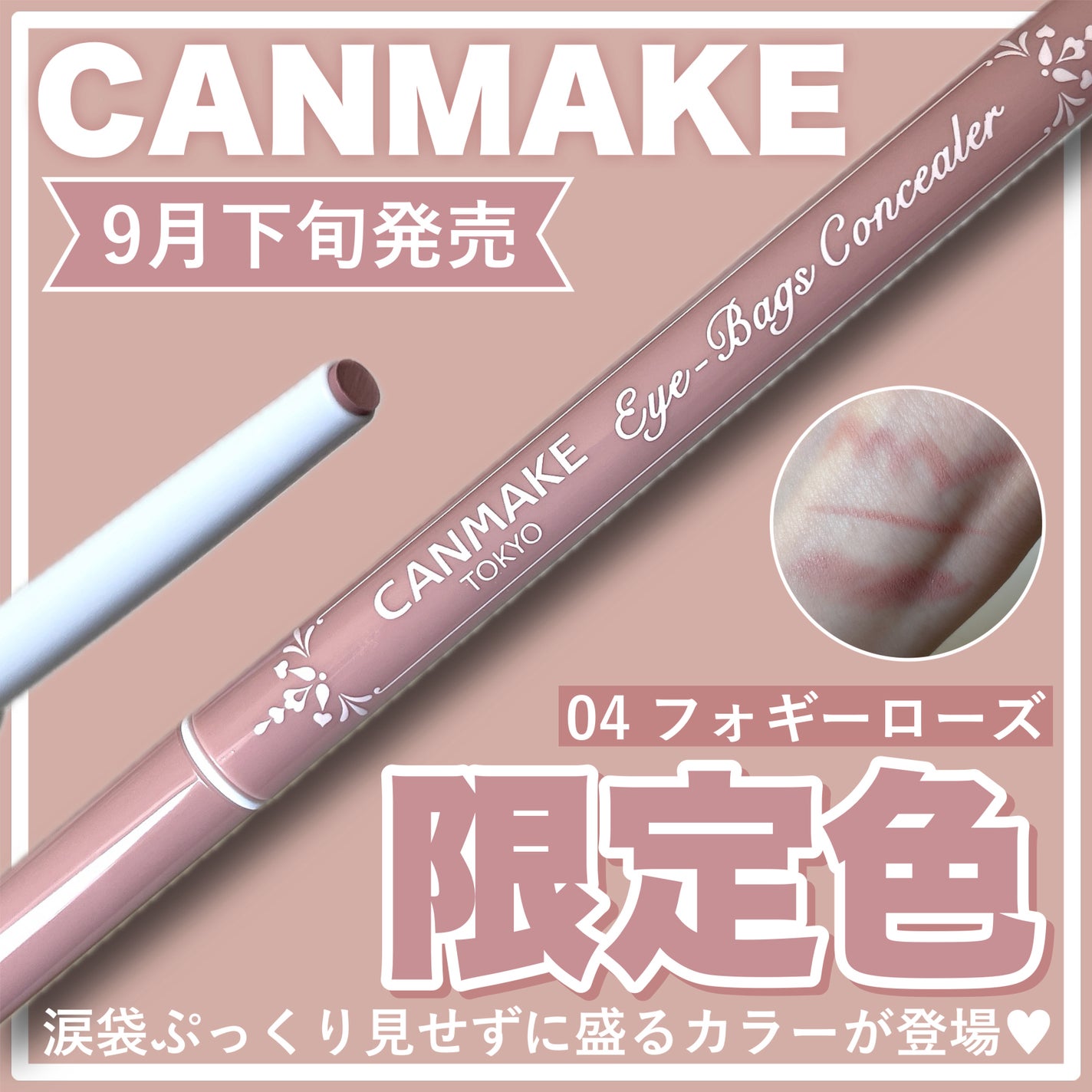 ã¢ã€ããã°ã³ã³ã·ãŒã©ãŒ/ãã£ã³ã¡ã€ã¯/ãã³ã·ã«ã³ã³ã·ãŒã©ãŒã䜿ã£ãã¯ãã³ãïŒ1æç®ïŒ