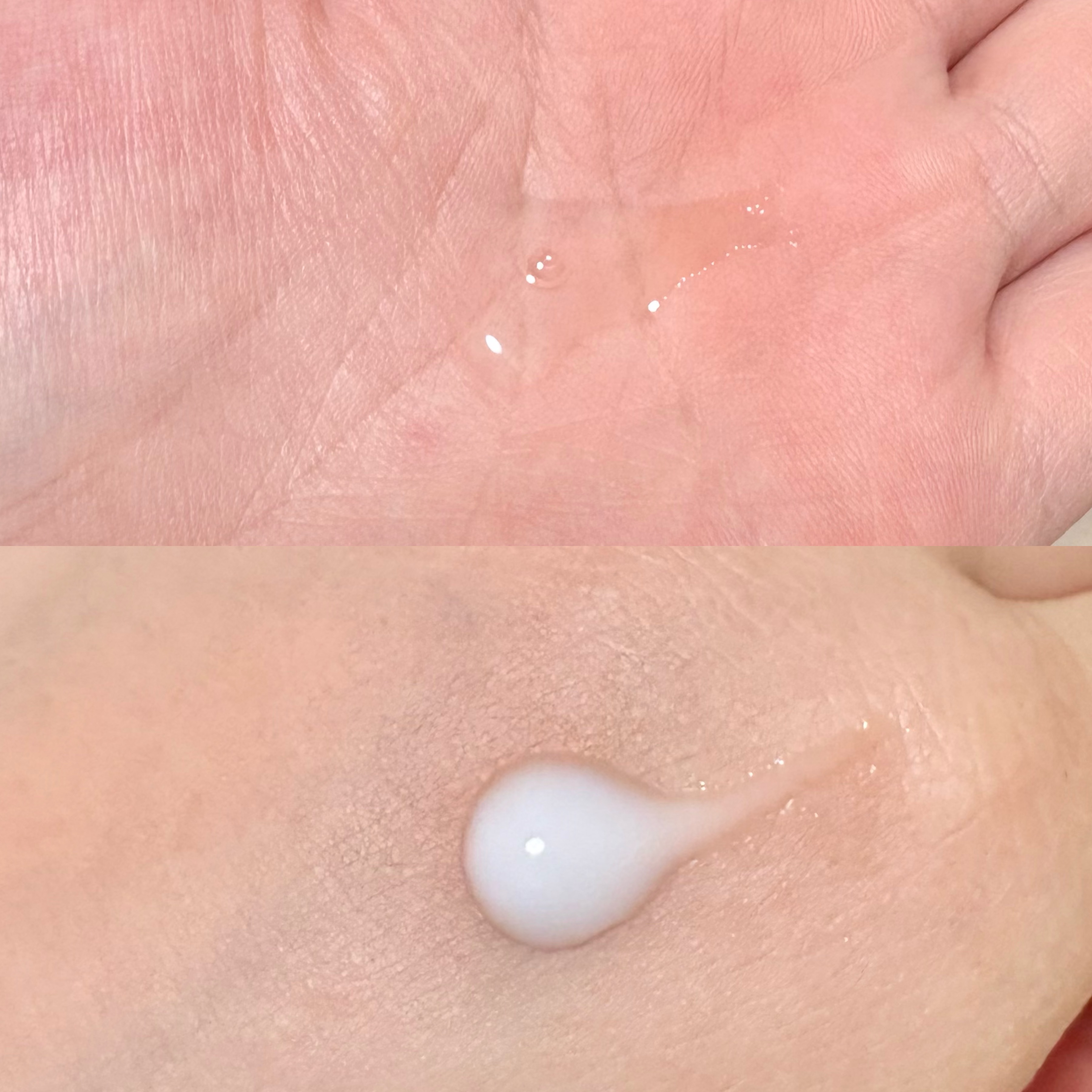 モイストケア セット MB/d プログラム/トライアルキットを使ったクチコミ（2枚目）