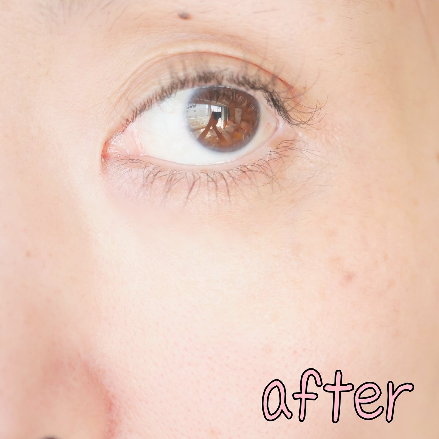 REJURAN ポアタイトニングアンプル 30ml/REJURAN COSMETICS/美容液を使ったクチコミ(8枚目)