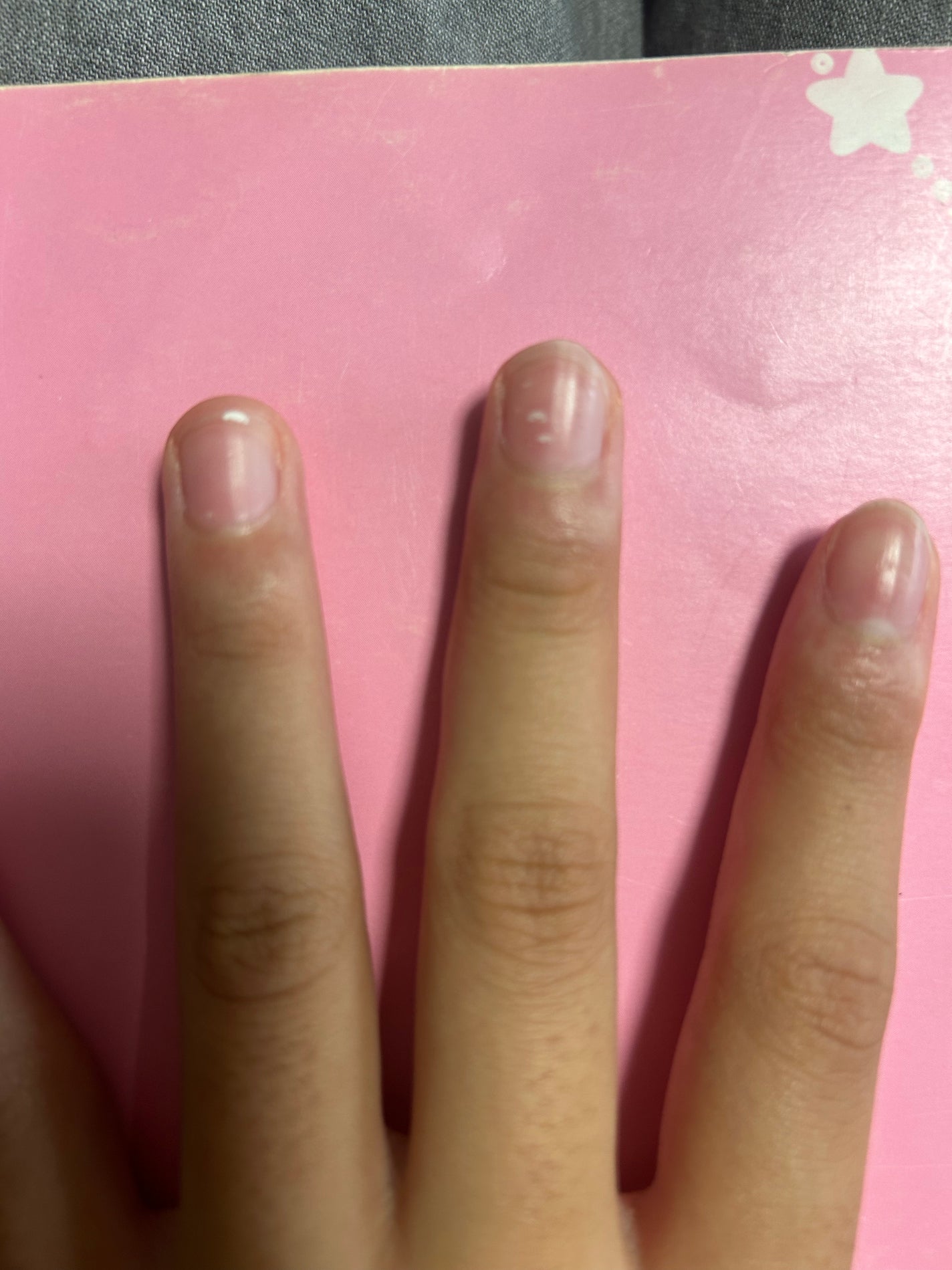 もひまる on LIPS 「タンスとかにはさんだらしろくなるの私だけかな...?まじで関係..」(1枚目)